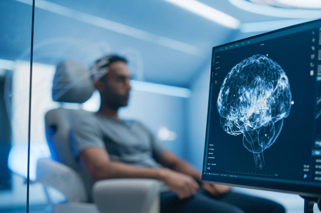 Medical Brain Scan on Computer Screen