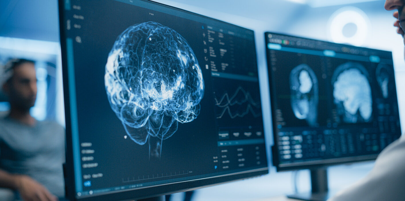 Medical Brain Scans on Multiple Computer Screens